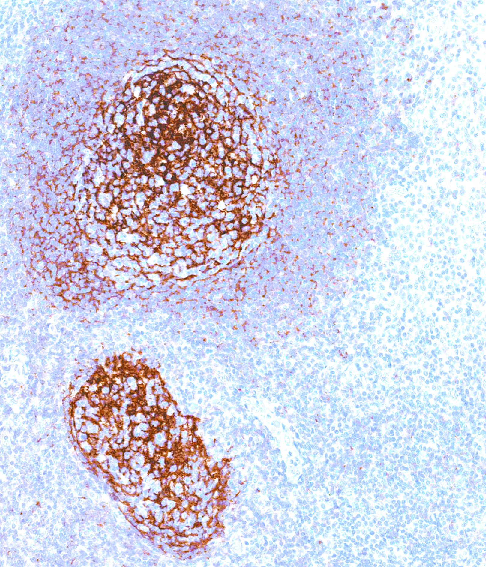 GeneAb™ CD21 [IHC533] on Tonsil