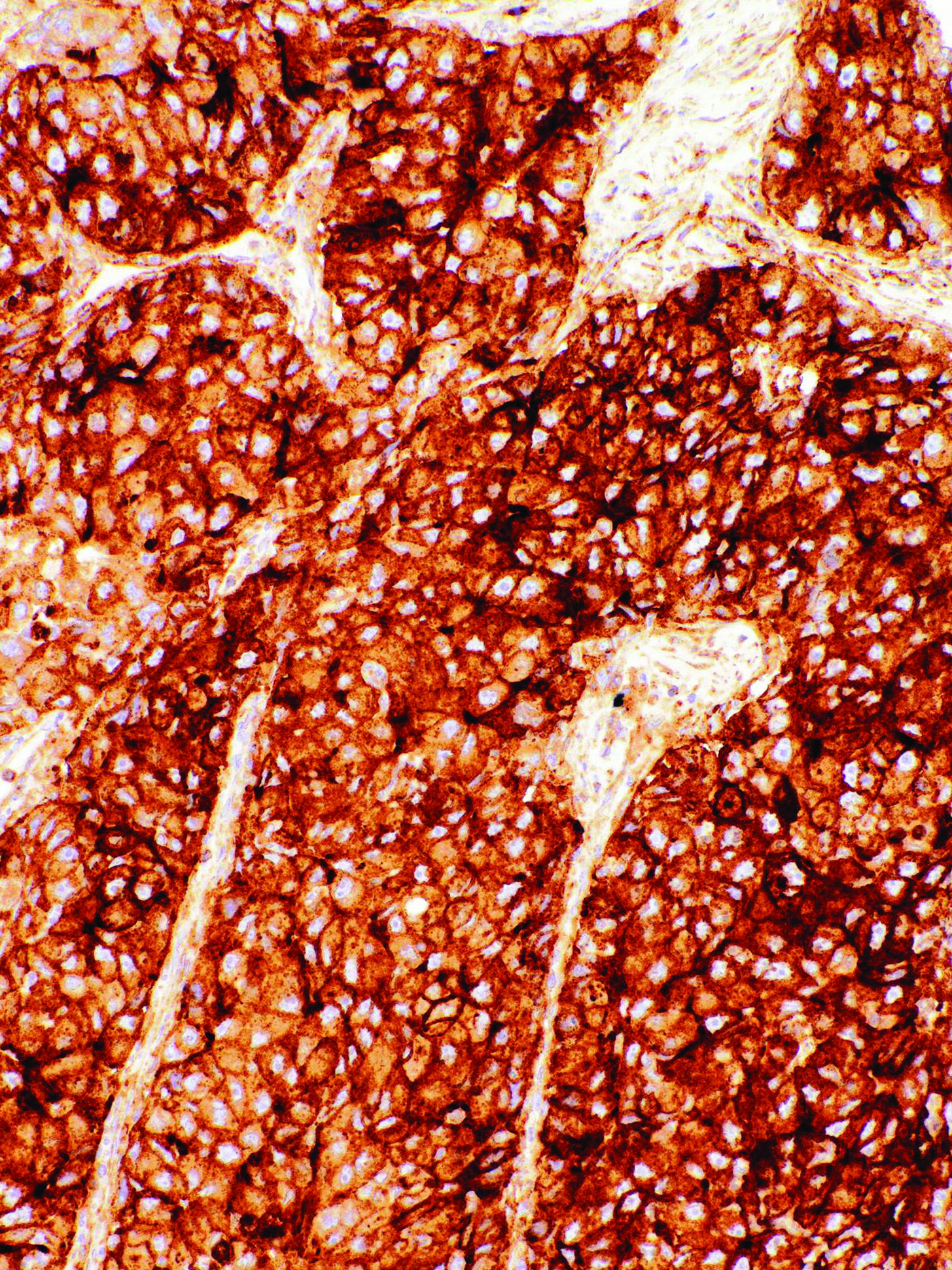 GeneAb™ CD317 [IHC317] on Lung