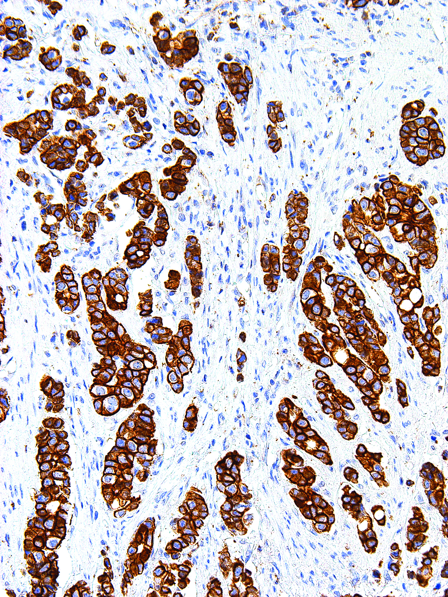 GeneAb™ CD99 [IHC099] on Esophagus