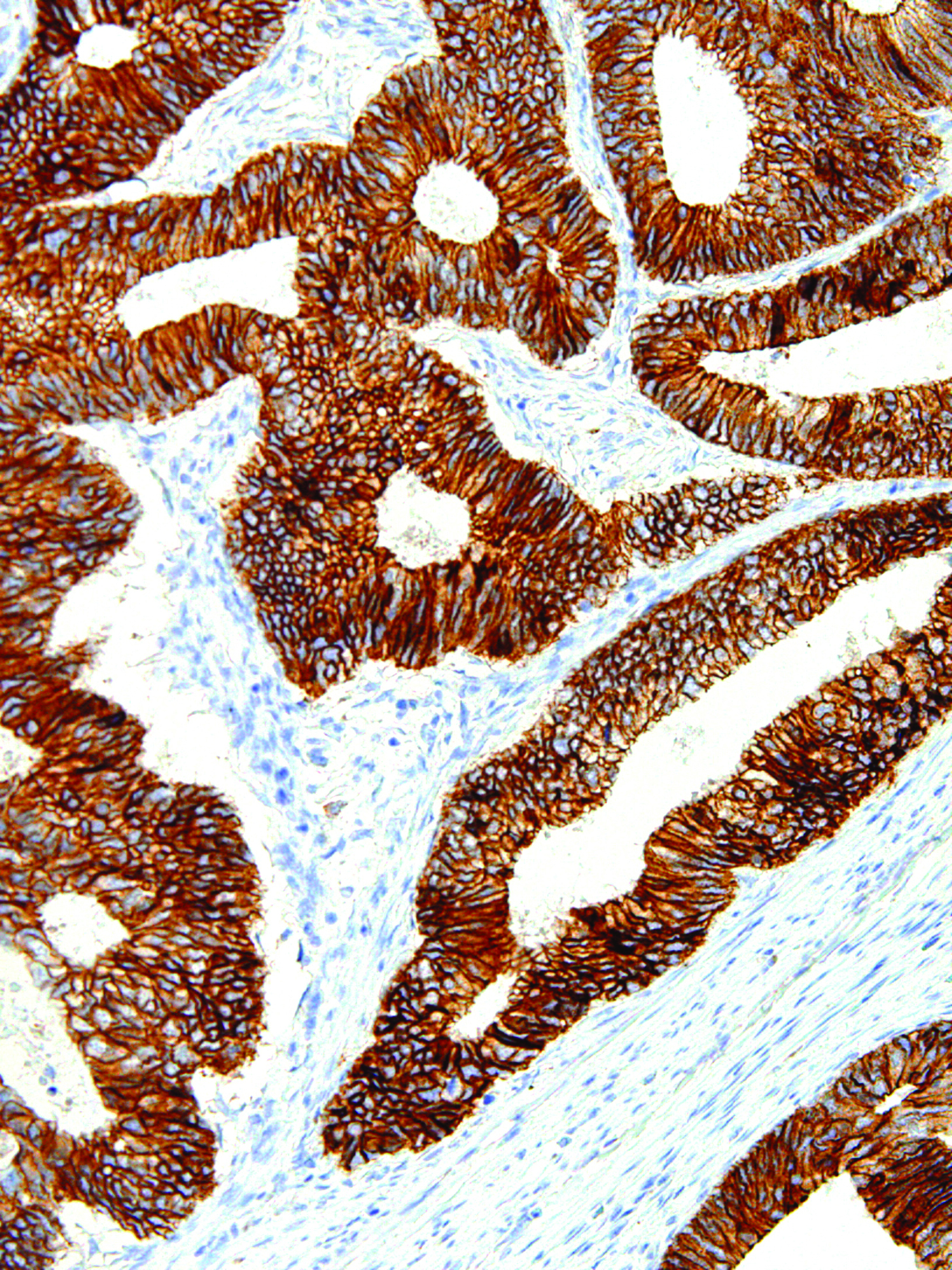 GeneAb™ E-cadherin [IHC564] on Colon