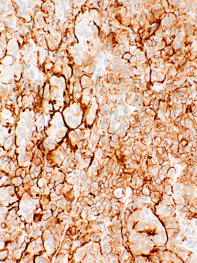 GeneAb™ Podoplanin [IHC650] on Mesothelia