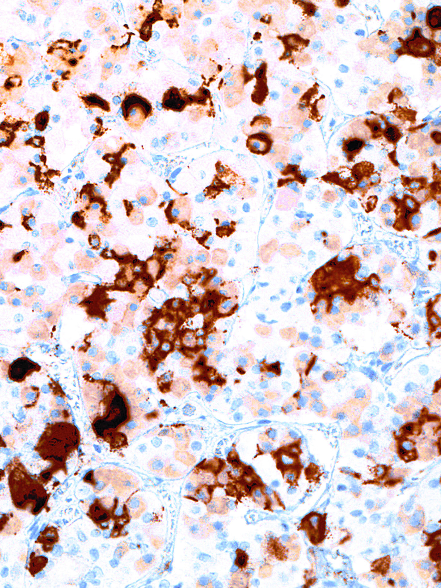 GeneAb™ Prolactin [IHC652] on Pituitary Gland