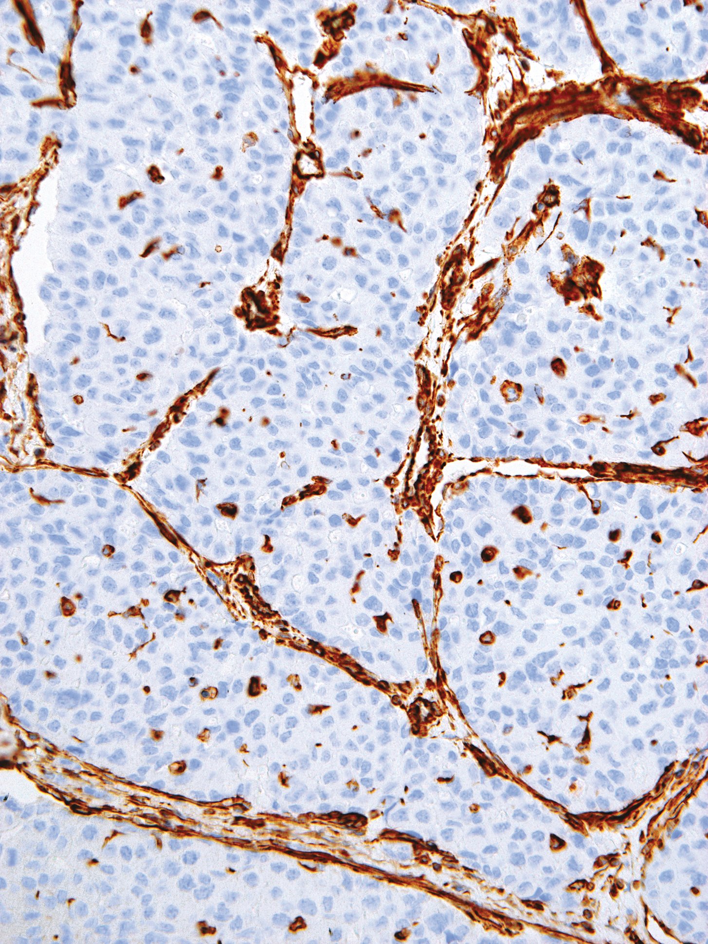 GeneAb™ Vimentin [IHC684] on Liver